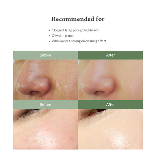 Dr. Althea – Premium Quick Step Sebum Cleanser