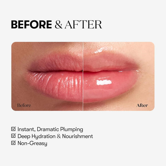 VT Reedle Shot Lip Plumper Expert (10ml)