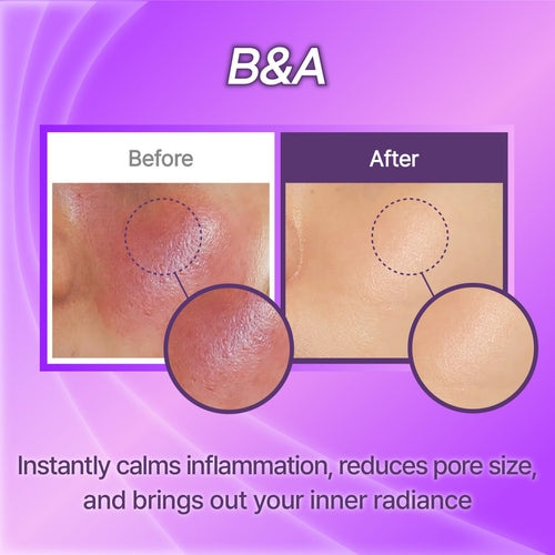 HYAAHH Synergy Mask Pad – 10 unidades (130 ml)