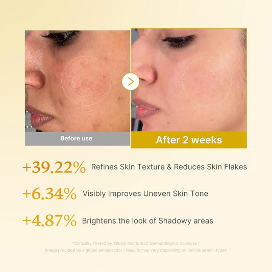 Medicube - Kojic Acid Turmeric Resurfacing Toner (250ml)