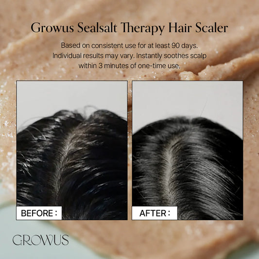 Growus – Sea Salt Therapy Scalp Scaler [200g]