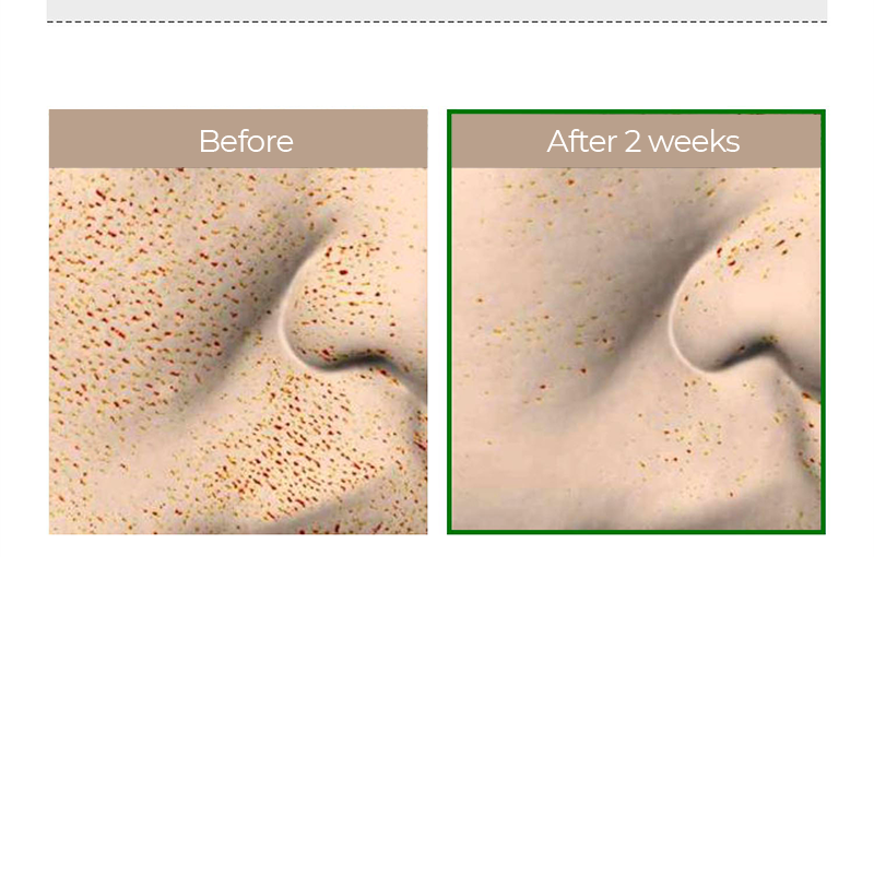 VT – Reedle Shot 100 Serum Set [50 ml + 6 muestritas]