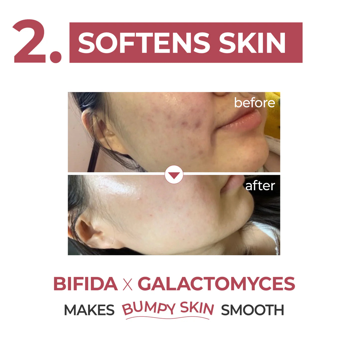 numbuzin - No. 3 Skin Softening Serum (50ml)