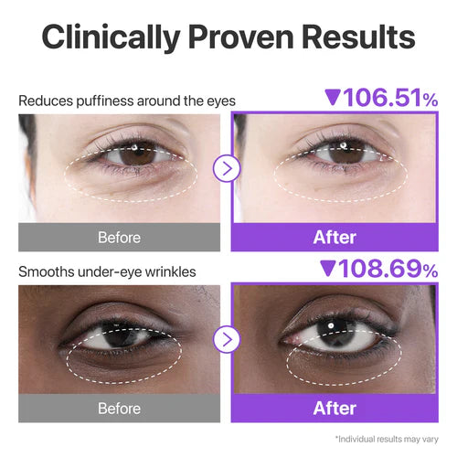 Numbuzin – NAD+ Collagen Under Eye Patches (5EA)