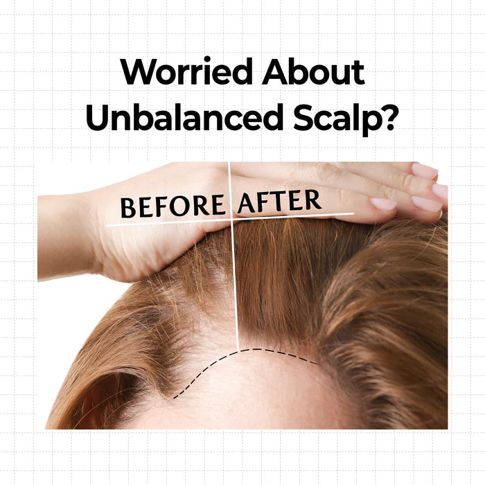 Kundal – 10X Caffeine Strengthening Scalp Serum 10ml