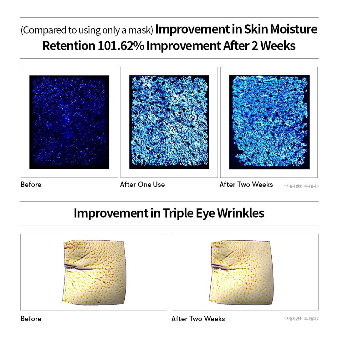 VT PDRN Reedle Shot 2-Step Hydrogel Mask