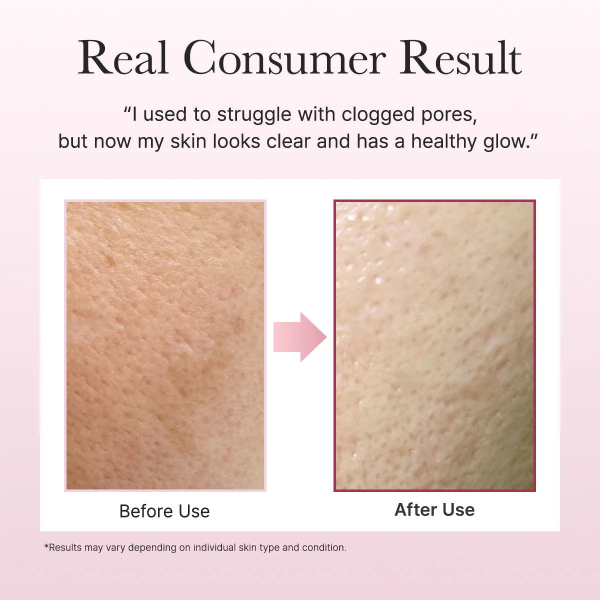 Arencia Fresh Rosehip Rice Mochi Cleanser 120g