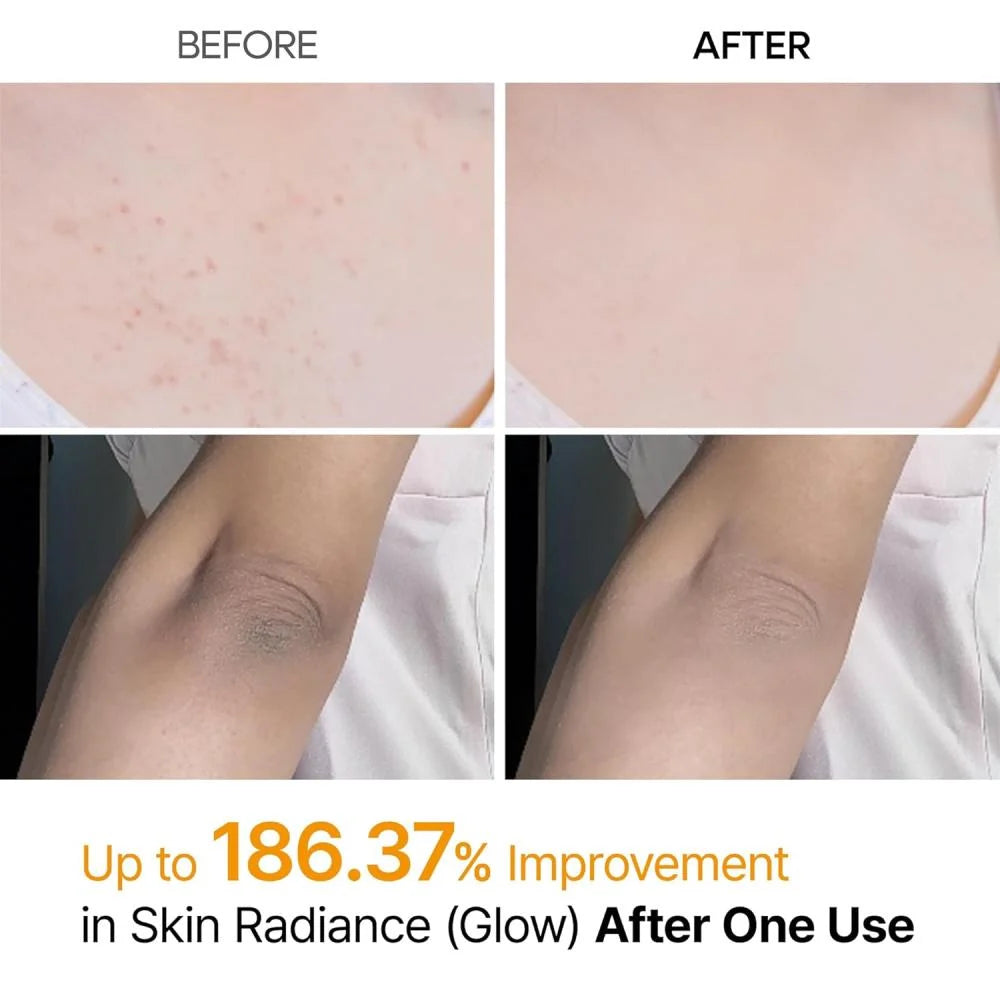 Dr. Melaxin Peel Shot Kojic Acid & Turmeric Body Spray (200ml)