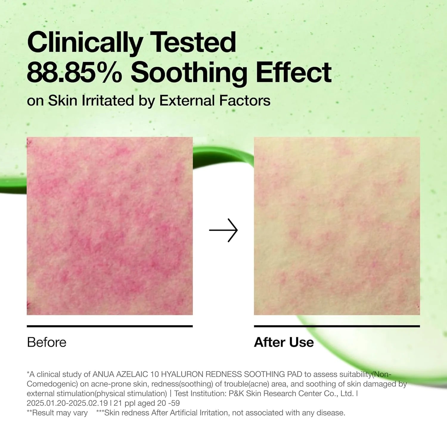 Anua Soothing Pad Azelaic 10 + Hyaluron – 90 Pads