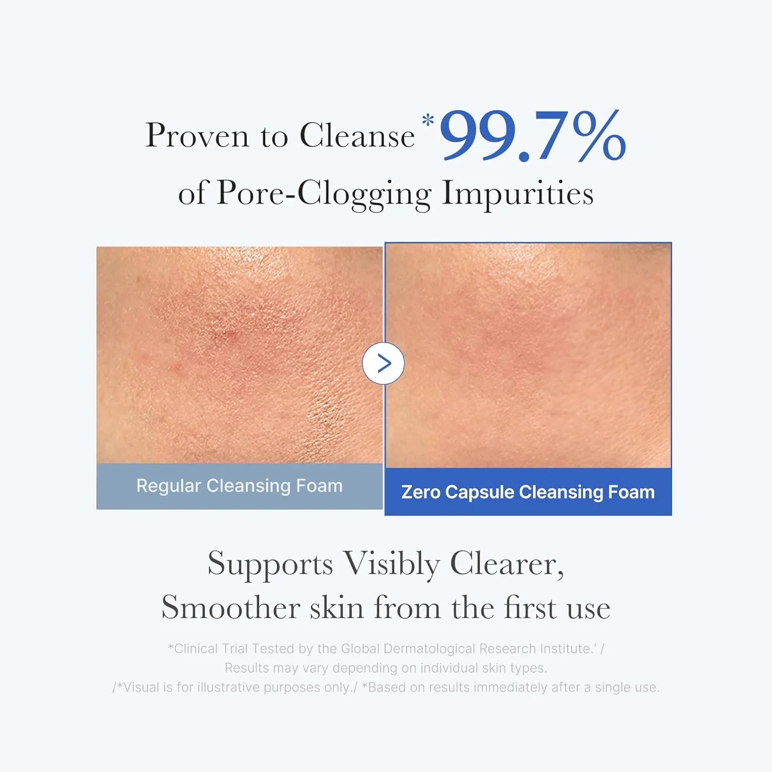 Medicube Zero Pore SA Clear Capsule Cleansing Foam (120g)