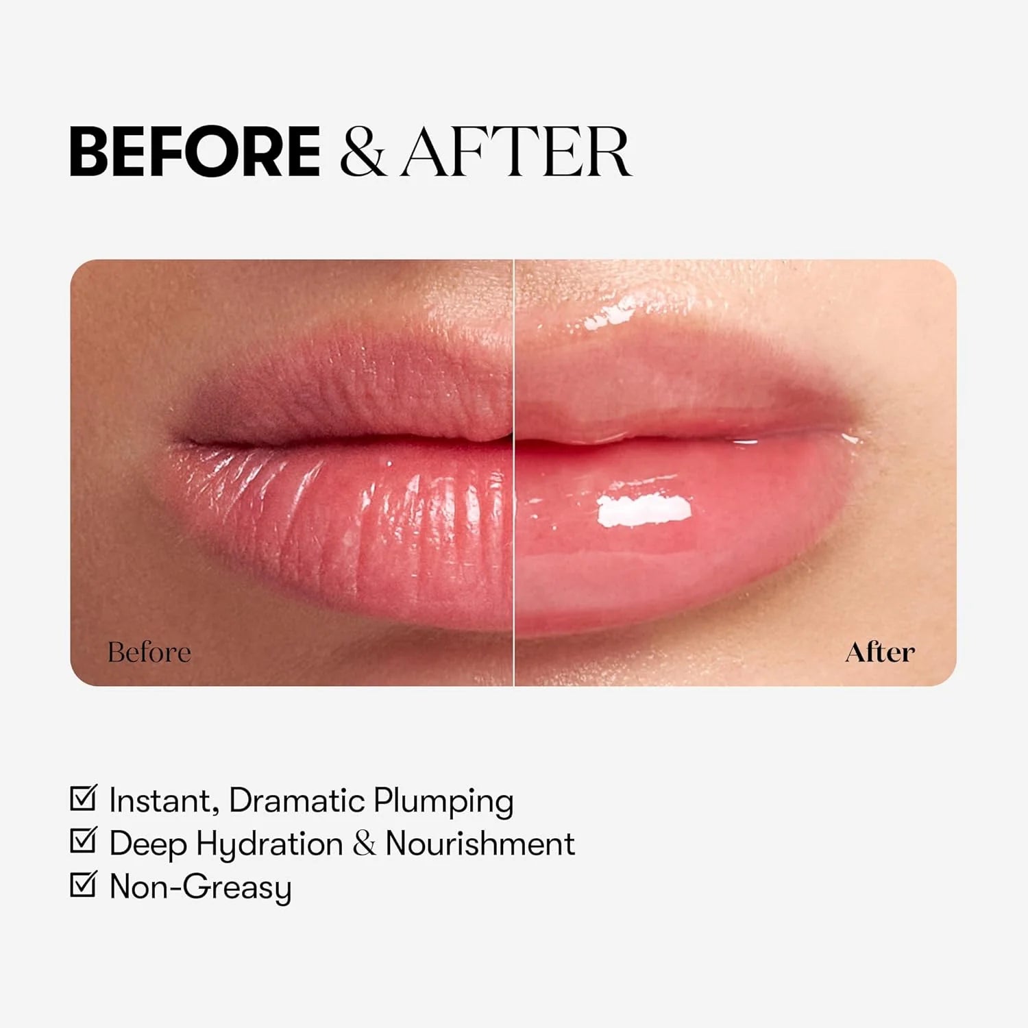VT Reedle Shot Lip Plumper Expert (10ml)