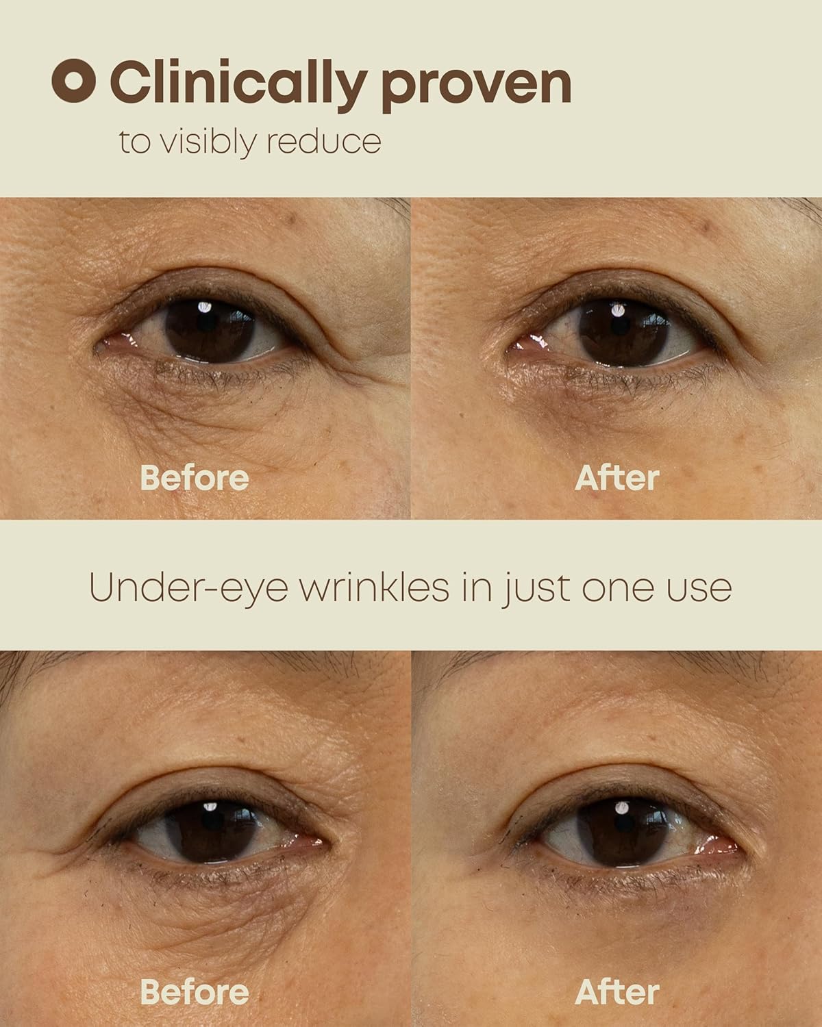 Nineless – Dual Effect Eye Cream (20 ml)