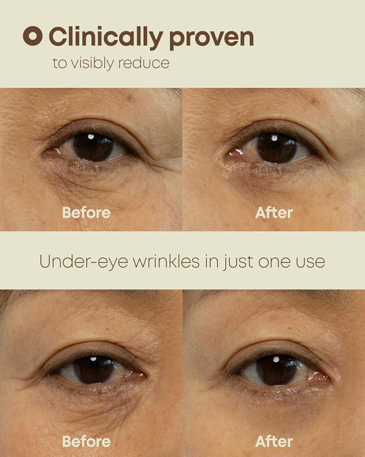 Nineless – Dual Effect Eye Cream (20 ml)