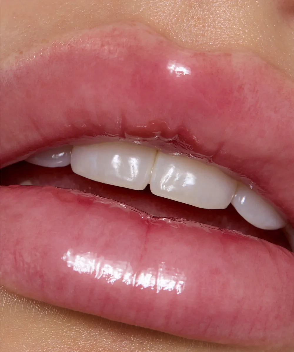 BEAUTY BAY – Lip Plump