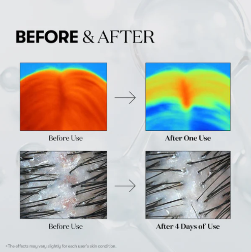 VT Cosmetics – PDRN Reedle Shot Hair Ampoule [300 dl]