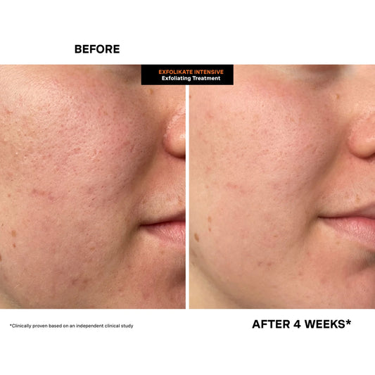 Kate Somerville – ExfoliKate Intensive Exfoliating Treatment [60 ml]