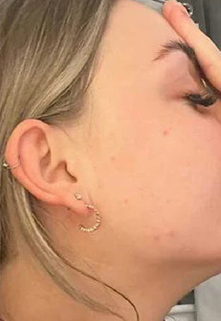 Carbon Theory – Vitamin C and Caffeine Facial Cleansing Bar