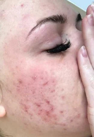 Carbon Theory – Vitamin C and Caffeine Facial Cleansing Bar