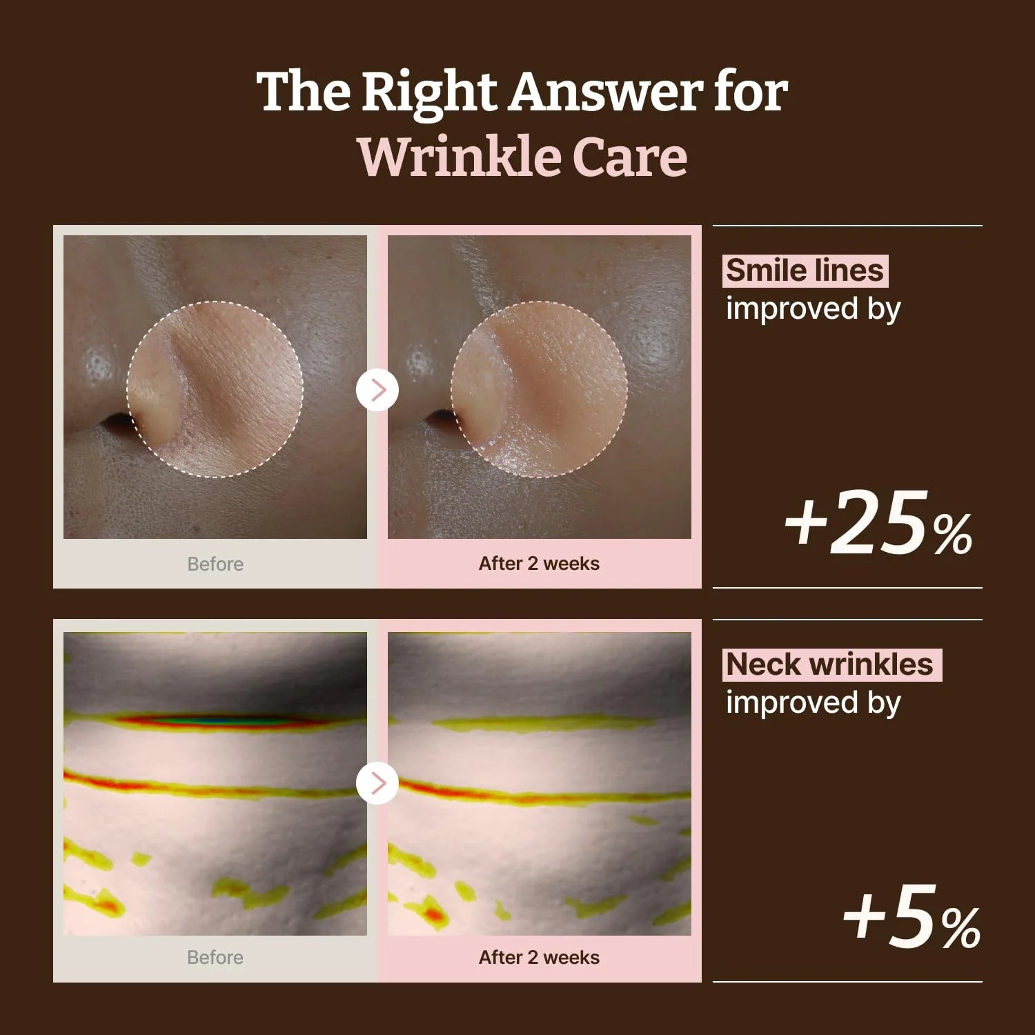 Dr. Reju All Advanced PDRN Rejuvenating Mask (Set de 4 unidades)