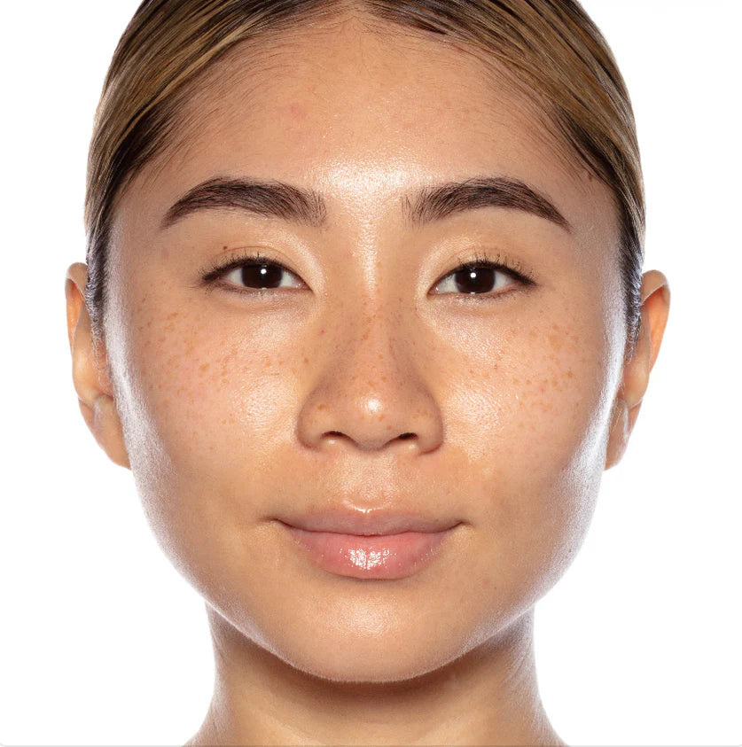 Sunday Riley – Good Genes All-In-One Lactic Acid Treatment 15ml