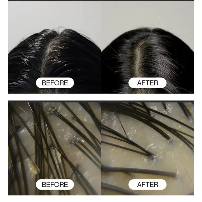Growus – Sea Salt Therapy Scalp Scaler [200g]