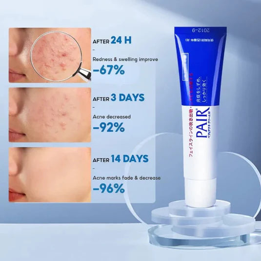 Lion Pair Acne Cream W – Crema Anti‑Inflamatoria para Brotes