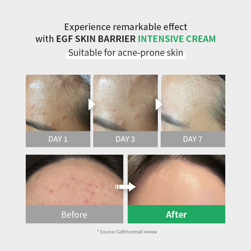 Zipiderm – EGF Skin Barrier Intensive Cream (80 ml)