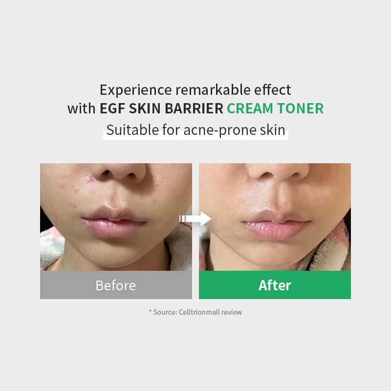 Zipiderm – EGF Skin Barrier Intensive Cream (80 ml)