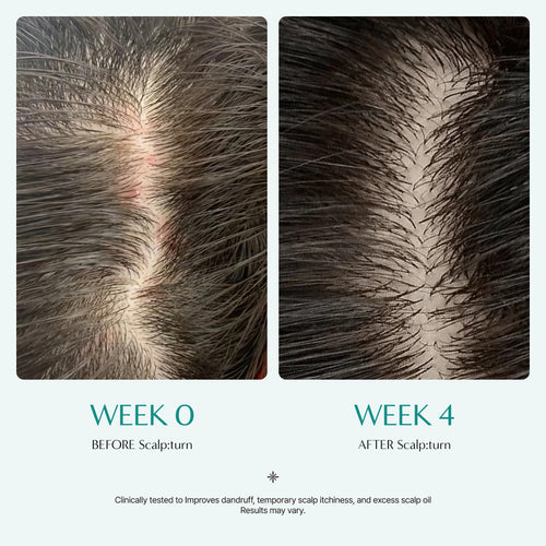 Lilyeve - Scalp:turn Cica PDRN Brush Ampoule Mini (30ml)