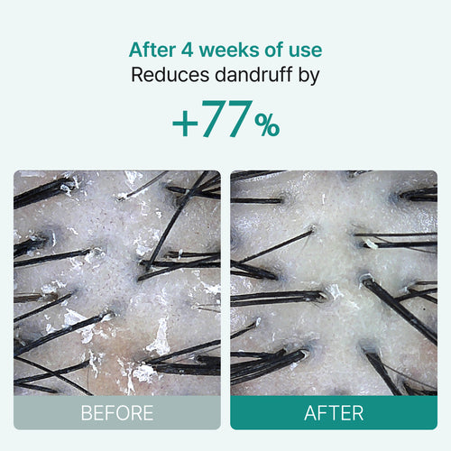 Lilyeve - Scalp:turn Cica PDRN Brush Ampoule Mini (30ml)